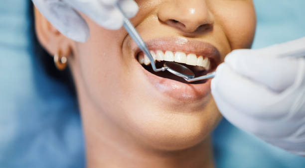 Best Emergency Denture Repair in Bondurant, IA